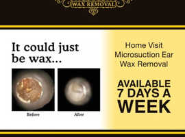 Ear wax removal