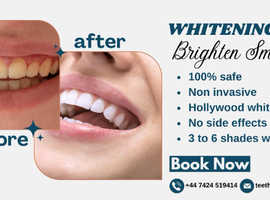 Special offer on Teeth whitening