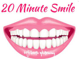20 Minute Self Service Teeth  Whitening