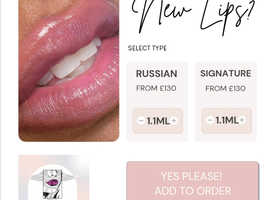 Lip filler £130