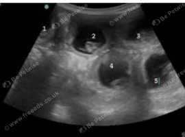 Dog and cat pregnancy ultrasound