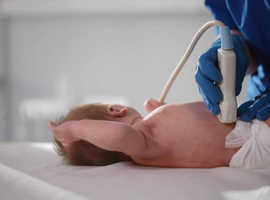 Paediatric Hernia Scan