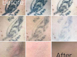 Eye for Ink Tattoo Studio  South Croydon London  Custom Tattoos Body  Piercing and Laser Tattoo Removal