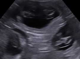 K9 pregnancy ultrasound and microchipping