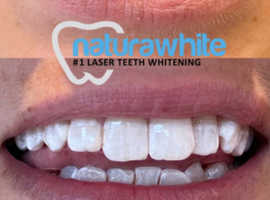Mobile cosmetic teeth whitening using the best in the buisness