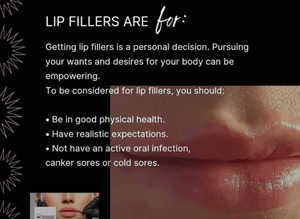 Lip filler