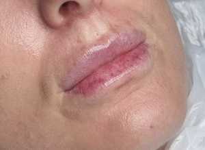 Semi permanent lip blush