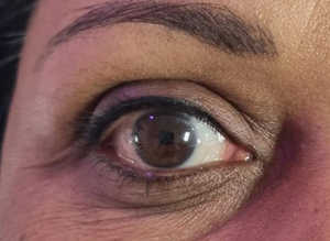 Semi-permanent eyeliner