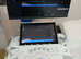 Pelvic Ultrasound Scans for Children