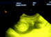 Ultrasound canine pregnancy confirmation scanning