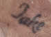 Laser Tattoo Removal