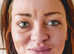 Non-Surgical Face Lifts and Body sculpting