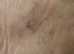 Laser Tattoo Removal